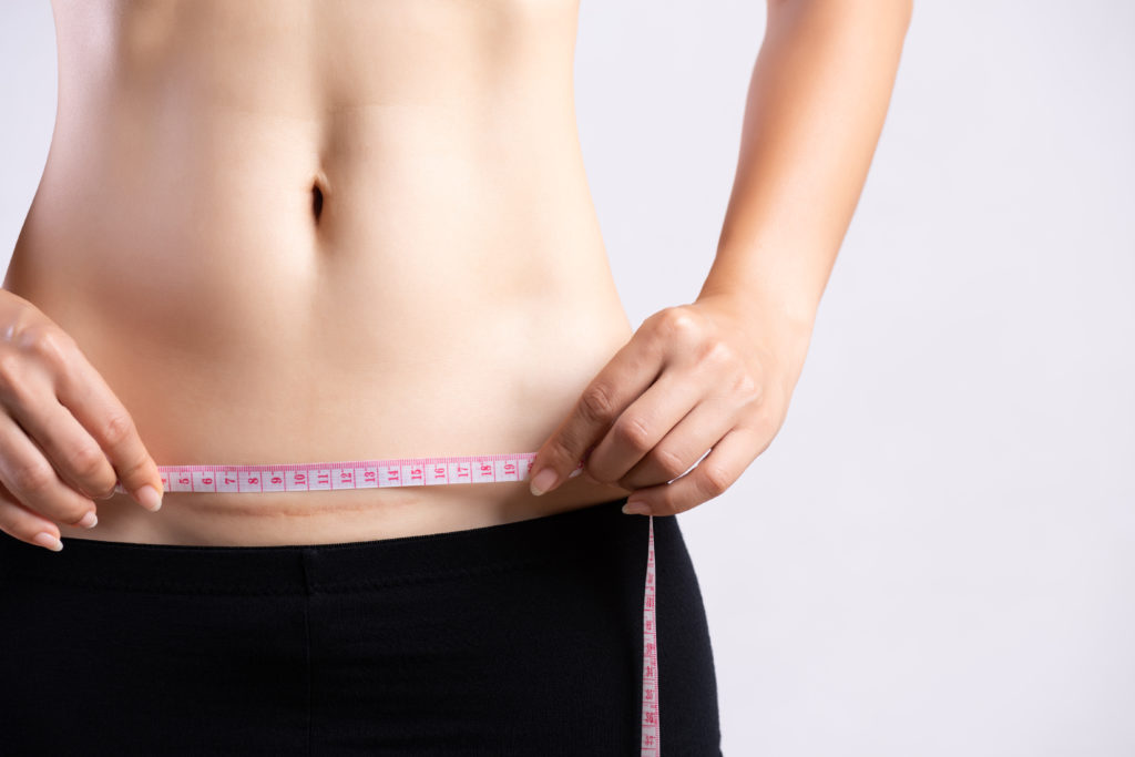 Narbe am Unterbauch